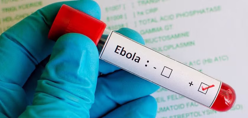 Brote de ébola en el Congo avanza de forma exponencial y supera las 2,500 muertes